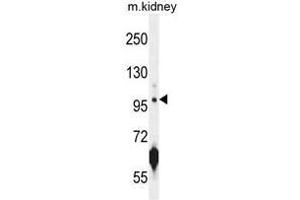 ATPGD1 Antibody (N-term) western blot analysis in mouse kidney tissue lysates (35µg/lane). (CARNS1 anticorps  (N-Term))