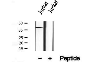 Western blot analysis of extracts from Jurkat, using Syntaxin 16 antibody. (Syntaxin 16 anticorps  (N-Term))