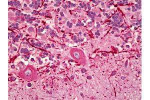 Anti-KDEL Receptor antibody IHC of human brain, cerebellum.