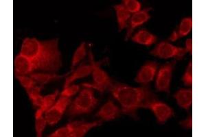 ABIN6274022 staining A549 by IF/ICC.