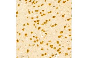 Immunohistochemistry of paraffin embedded mouse brain using BPTF (ABIN7073234) at dilution of 1:500 (400x lens) (BPTF anticorps)