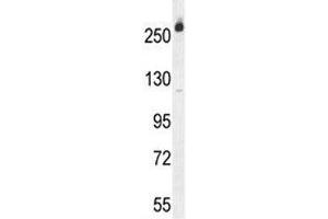 CAD antibody western blot analysis in Jurkat lysate.