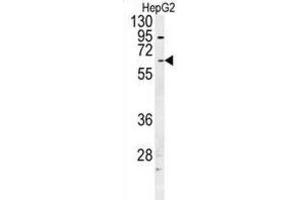 Western Blotting (WB) image for anti-UDP Glucuronosyltransferase 1 Family, Polypeptide A1 (UGT1A1) antibody (ABIN2997636) (UGT1A1 anticorps)