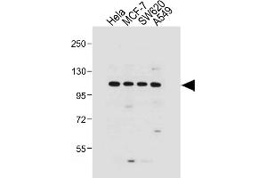 All lanes : Anti-G Antibody (N-term) at 1:1000 dilution Lane 1: Hela whole cell lysate Lane 2: MCF-7 whole cell lysate Lane 3: S whole cell lysate Lane 4: A549 whole cell lysate Lysates/proteins at 20 μg per lane. (GAA anticorps  (N-Term))