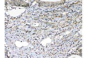 IHC analysis of VEGF Receptor 2  using anti-VEGF Receptor 2  antibody .