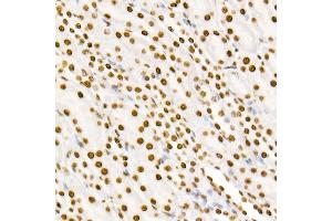 Immunohistochemistry of paraffin-embedded mouse kidney using Phospho-ST-Y705 Rabbit mAb (ABIN6135325, ABIN6136266, ABIN6136267 and ABIN7101883) at dilution of 1:100 (40x lens).