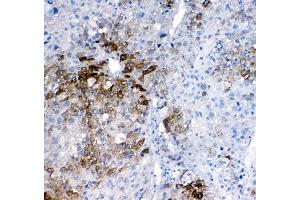 IHC analysis of GSTA1/A2/A3/A4/A5 using anti-GSTA1/A2/A3/A4/A5 antibody (ABIN5518995). (GSTA1 anticorps  (AA 2-222))