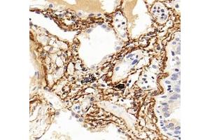 Immunohistochemistry analysis of paraffin-embedded human lung using,MFAP4 (ABIN7074614) at dilution of 1: 2000
