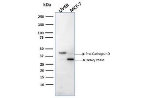 Western Blot Analysis of human liver tissue and MCF-7 cell lysates usingCathepsin D Mouse Monoclonal Antibody (CTSD/2781). (Cathepsin D anticorps  (AA 104-250))