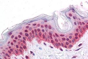 Human Skin: Formalin-Fixed, Paraffin-Embedded (FFPE)