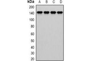 Western blot analysis of Dia 1 expression in MCF7 (A), HepG2 (B), mouse liver (C), mouse lung (D) whole cell lysates. (CYB5R3 anticorps)