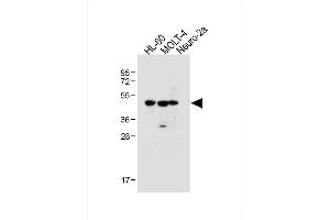 All lanes : Anti-BLMH Antibody (Center) at 1:1000 dilution Lane 1: HL-60 whole cell lysate Lane 2: MOLT-4 whole cell lysate Lane 3: Neuro-2a whole cell lysate Lysates/proteins at 20 μg per lane.