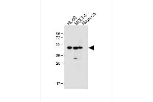 All lanes : Anti-BLMH Antibody (Center) at 1:1000 dilution Lane 1: HL-60 whole cell lysate Lane 2: MOLT-4 whole cell lysate Lane 3: Neuro-2a whole cell lysate Lysates/proteins at 20 μg per lane.