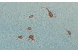 Immunohistochemical staining using MAb-Ad-H-2 antibody on Adenovirus AV2 infected Hela cells (Human Adenovirus Hexon (HAdV Hexon) anticorps)
