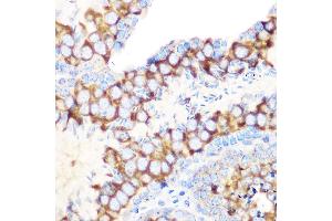 Immunohistochemistry of paraffin-embedded mouse testis using RUVBL1/TIP49A/PONTIN Rabbit mAb (ABIN7270118) at dilution of 1:100 (40x lens).