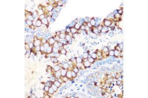 Immunohistochemistry of paraffin-embedded mouse testis using RUVBL1/TIP49A/PONTIN Rabbit mAb (ABIN7270118) at dilution of 1:100 (40x lens). (RUVBL1 anticorps)