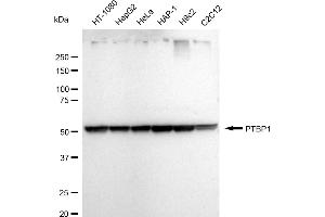 Western blotting analysis using PTBP1 antibody (ABIN7799882). (Recombinant PTBP1 anticorps)