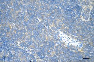Immunohistochemistry was performed on paraffin-embedded mouse spleen using RHOA antibody (ABIN7800142), 1:200). (Recombinant RHOA anticorps)