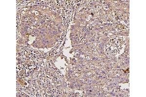 IHC analysis of IRS1 using anti-IRS1 antibody (ABIN7599659). (IRS1 anticorps  (AA 1041-1242))