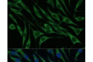 Immunofluorescence analysis of L929 cells using VARS Polyclonal Antibody at dilution of 1:100 (40x lens).