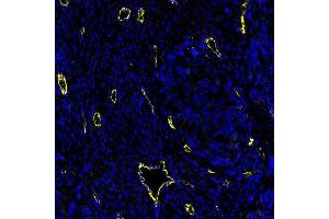 Immunofluorescence (IF) image for anti-Cadherin 5 (CDH5) (AA 48-599) antibody (ABIN7455190) (Recombinant Cadherin 5 anticorps  (AA 48-599))