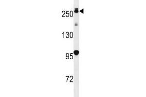 PARK8 antibody western blot analysis in mouse lung tissue lysate.