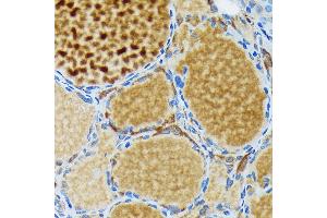 Immunohistochemistry of paraffin-embedded rat thyroid using Thyroid Peroxidase Rabbit mAb (ABIN7270865) at dilution of 1:100 (40x lens). (TPO anticorps)
