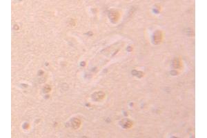 Used in DAB staining on fromalin fixed paraffin-embedded Heart tissue