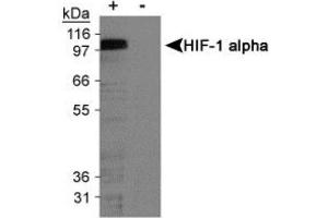 Image no. 3 for anti-Hypoxia Inducible Factor 1, alpha Subunit (Basic Helix-Loop-Helix Transcription Factor) (HIF1A) (AA 432-528) antibody (ABIN363203)