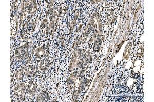 IHC analysis of DYNLL1/PIN using anti-DYNLL1/PIN antibody (ABIN7599570).