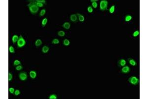 Immunofluorescent analysis of PC-3 cells using ABIN7175905 at dilution of 1:100 and Alexa Fluor 488-congugated AffiniPure Goat Anti-Rabbit IgG(H+L)
