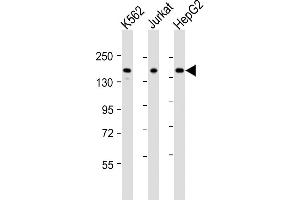 All lanes : Anti-IQSEC2 Antibody (Center) at 1:2000 dilution Lane 1: K562 whole cell lysates Lane 2: Jurkat whole cell lysates Lane 3: HepG2 whole cell lysates Lysates/proteins at 20 μg per lane. (IQSEC2 anticorps  (AA 451-484))