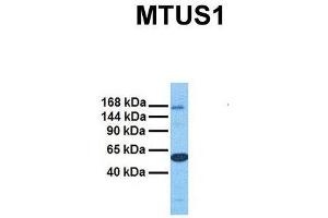 Host:  Rabbit  Target Name:  MTUS1  Sample Tissue:  Human Ovary Tumor  Antibody Dilution:  1.