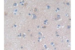 Detection of DDAH1 in Human Cerebrum Tissue using Polyclonal Antibody to Dimethylarginine Dimethylaminohydrolase 1 (DDAH1)