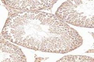Immunohistochemistry analysis of paraffin-embedded mouse testis using,NCKAP1 (ABIN7074784) at dilution of 1: 8000
