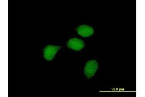 Immunofluorescence of purified MaxPab antibody to BCL3 on HeLa cell. (BCL3 anticorps  (AA 1-446))