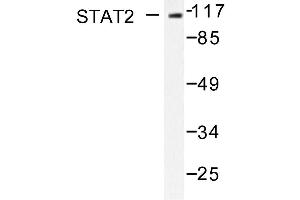 Image no. 1 for anti-Signal Transducer and Activator of Transcription 2, 113kDa (STAT2) antibody (ABIN271825) (STAT2 anticorps)