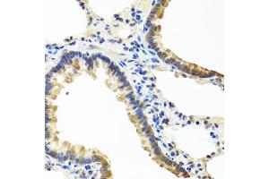 Immunohistochemistry of paraffin-embedded rat lung using ANGPT1 antibody (ABIN5974767) at dilution of 1/100 (40x lens). (Angiopoietin 1 anticorps)