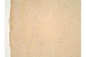 IHC analysis of PPA1 using anti-PPA1 antibody (ABIN6719527). (Pyrophosphatase (Inorganic) 1 (PPA1) (AA 7-236) anticorps)