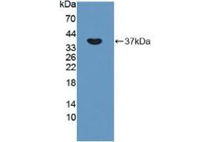 Western blot analysis of recombinant Rat OXTR. (Oxytocin Receptor anticorps  (AA 43-129))