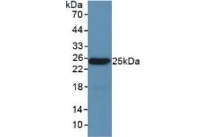Western blot analysis of recombinant Mouse LEP. (Leptin anticorps  (AA 22-167))