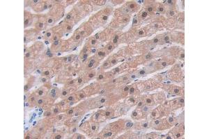 IHC-P analysis of Human Tissue, with DAB staining. (PTMA anticorps  (AA 2-111))