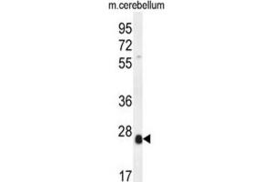 Western Blotting (WB) image for anti-Scleraxis (SCXA) antibody (ABIN5015284) (SCXA anticorps)