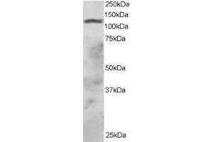 ABIN184814 staining (2µg/ml) of HepG2 lysate (RIPA buffer, 30µg total protein per lane). (RNF31 anticorps  (C-Term))