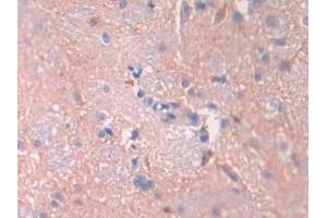 Detection of IL1R1 in Rat Spinal cord Tissue using Polyclonal Antibody to Interleukin 1 Receptor Type I (IL1R1)