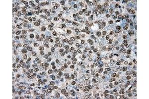 Immunohistochemical staining of paraffin-embedded colon tissue using anti-PTPRE mouse monoclonal antibody. (PTPRE anticorps)