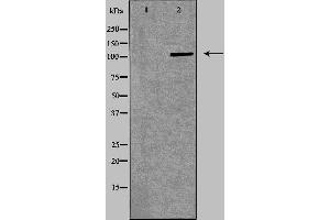 Western blot analysis of Jurkat  lysate using ITGA4 antibody. (ITGA4 anticorps  (C-Term))