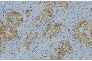 ABIN6274622 at 1/100 staining Human uterus tissue by IHC-P.