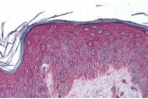 Human Skin: Formalin-Fixed, Paraffin-Embedded (FFPE) (APC2 anticorps  (AA 849-898))