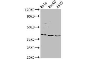 Western Blot Positive WB detected in: Hela whole cell lysate, HepG2 whole cell lysate, A549 whole cell lysate All lanes: NANS antibody at 5. (NANS anticorps  (AA 132-259))